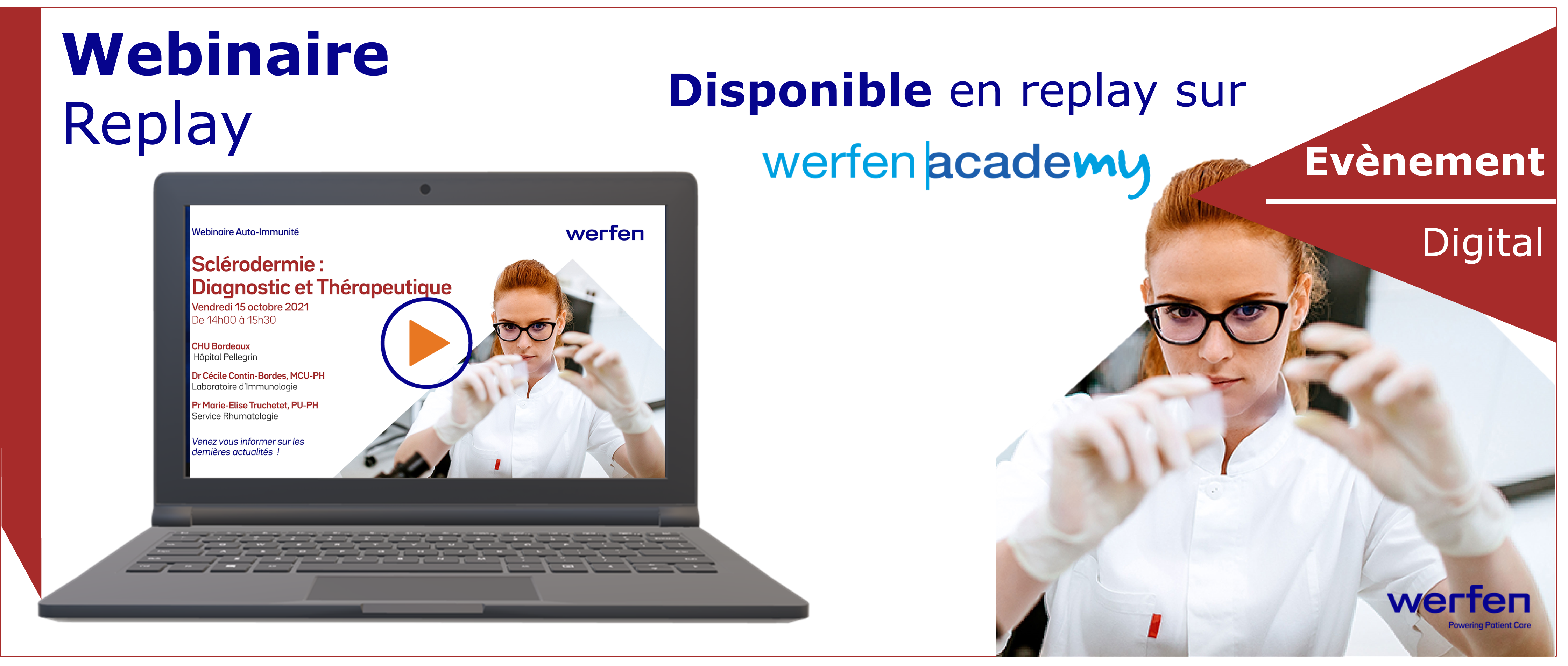 Sclérodermie